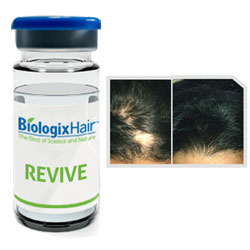 biologix hair growth treatment in women