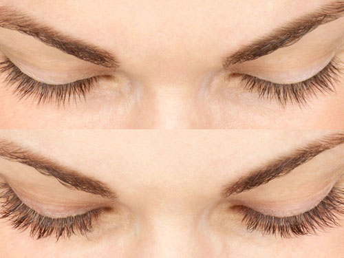 Can I Use Latisse for Hair Growth Instead of Growing Eyelashes?