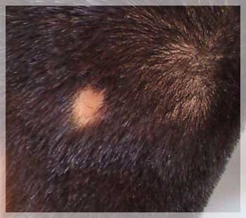 alopecia areata photo image