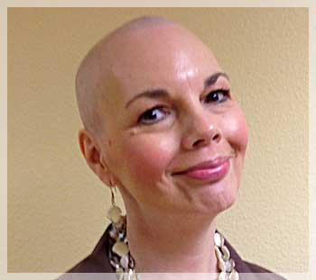 hair loss after chemo photo image