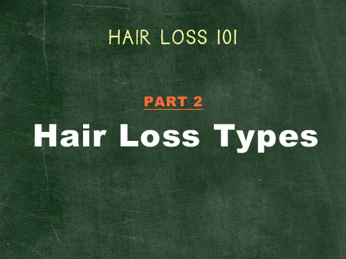 hair loss 101 hair loss types