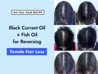 Black Currant Oil + Fish Oil for Reversing Female Hair Loss black currant seed oil and fish oil for thinning hair regrowth