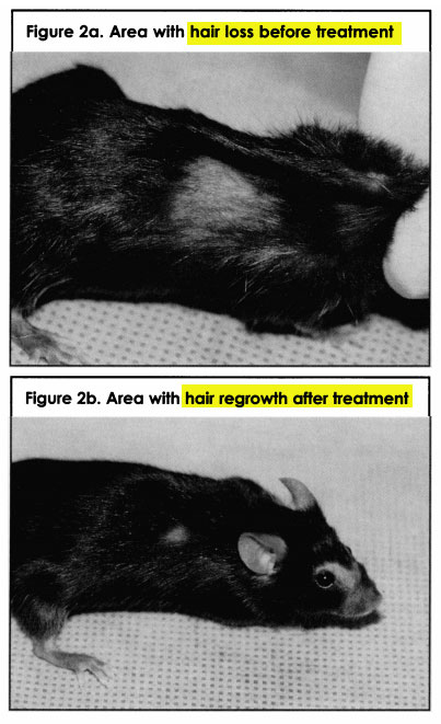 polyphenols from green tea for hair loss regrowth