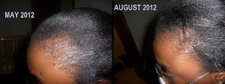 Jamaican black castor oil before and after pictures 2
