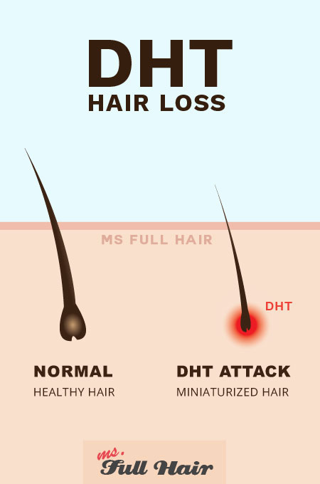 dht inositol alopecia hair loss