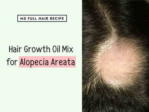 Use These Hair Growth Essential Oils If You Have Alopecia Areata Hair growth essential oils mix for alopecia areata