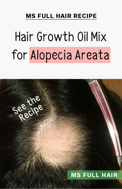 Hair growth essential oils mix for alopecia areata