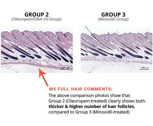 olive oil for hair loss minoxidil comparison