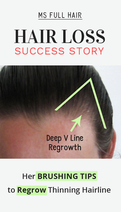 boar bristle brush receding hairline to regrow hair