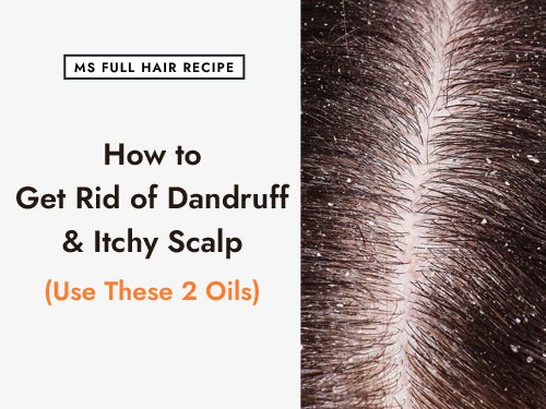 Jojoba Oil Recipe for Getting Rid of Dandruff, Dry and Itchy Scalp jojoba oil dandruff itchy scalp recipe