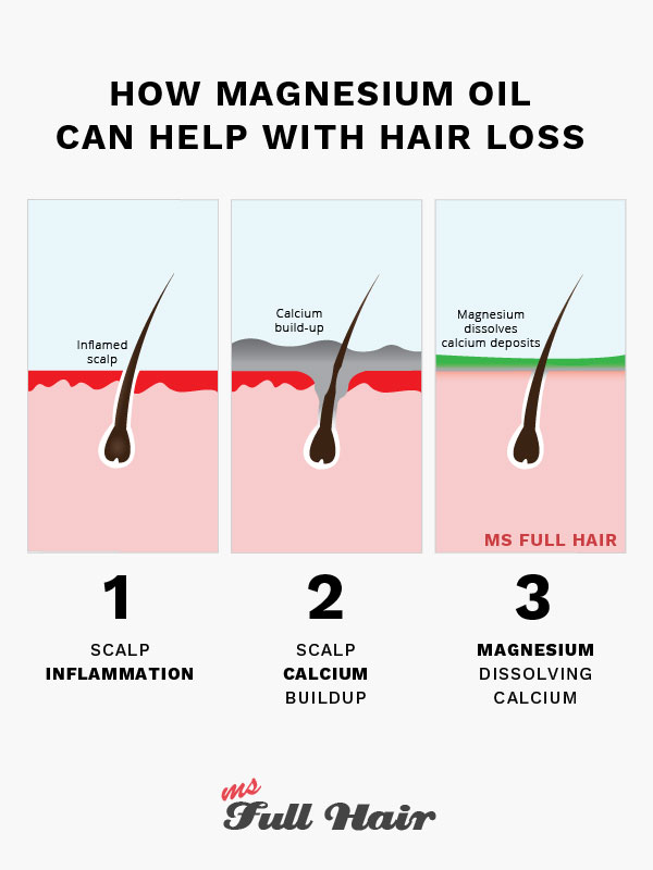 magnesium oil for hair growth