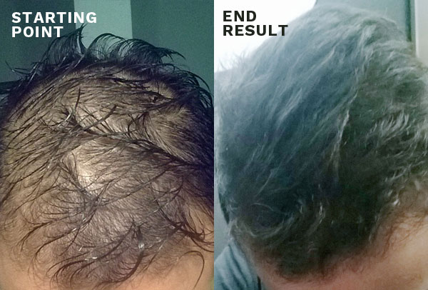 hair thickening products before and after photos