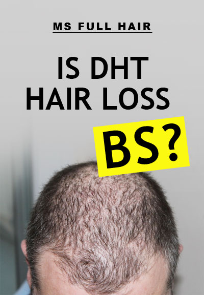 dht hair loss baldness cure myth