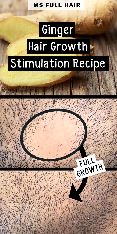 ginger hair growth stimulation recipe for alopecia areata hair loss