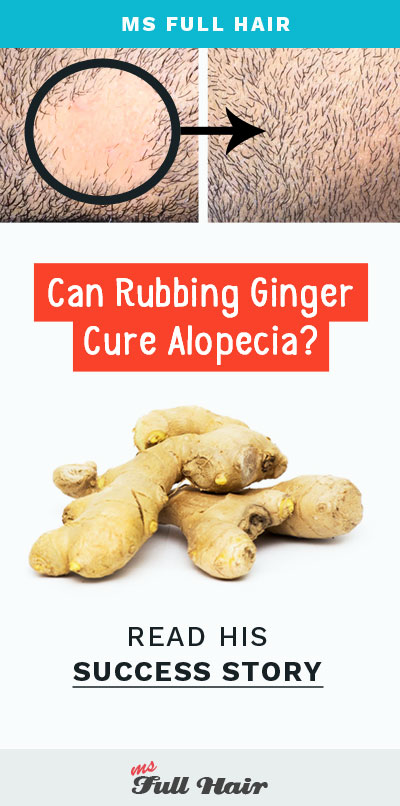 rubbing ginger juice for hair loss on scalp success story