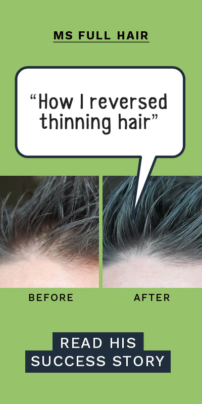 what to do for thinning hair on top of head
