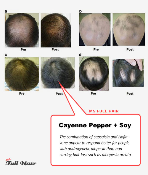 cayenne pepper and soy isoflavones for hair loss baldness