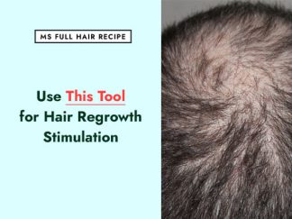 You Need THIS Tool to Accelerate Hair Regrowth hair growth recipe to reverse male pattern hair loss