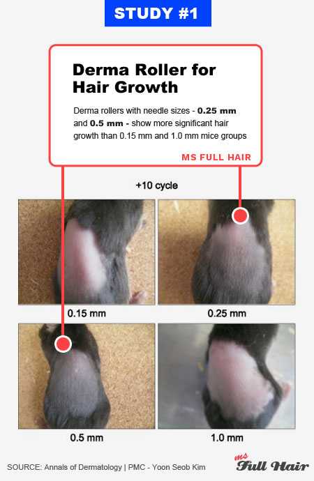derma roller for hair growth needle size from microneedling studies
