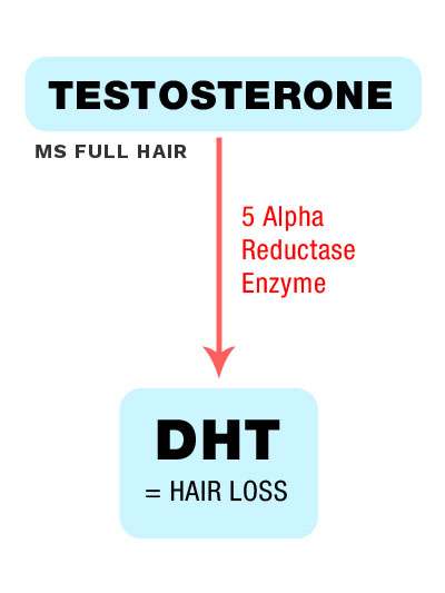 rosemary extract 5a reductase inhibiting dht blocking property