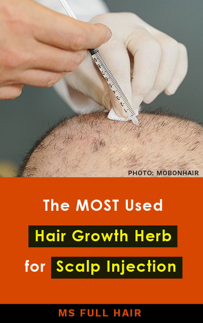 pharmacopuncture for hair loss stimulating hair regrowth